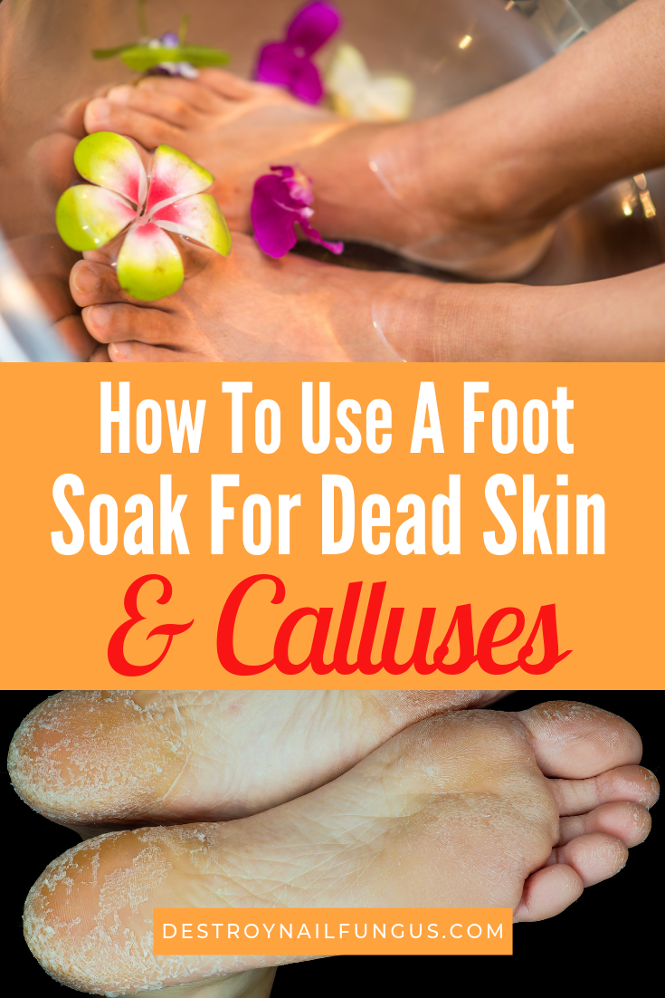 Foot Soak To Remove Dead Skin And Calluses