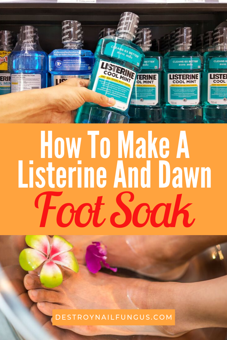 listerine and dry feet