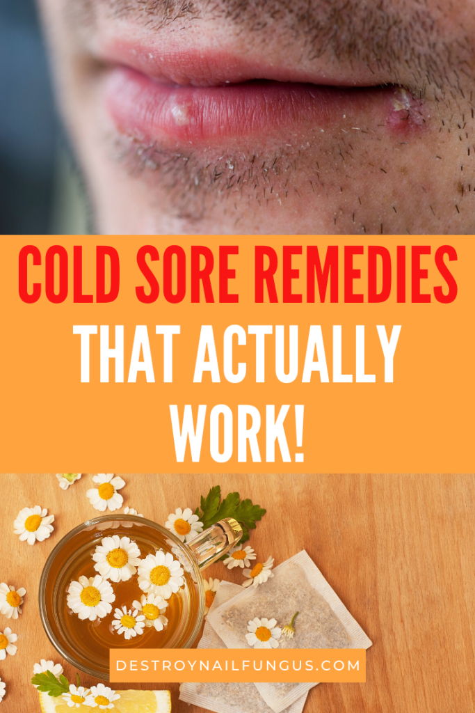 abridge cold sore treatment reviews