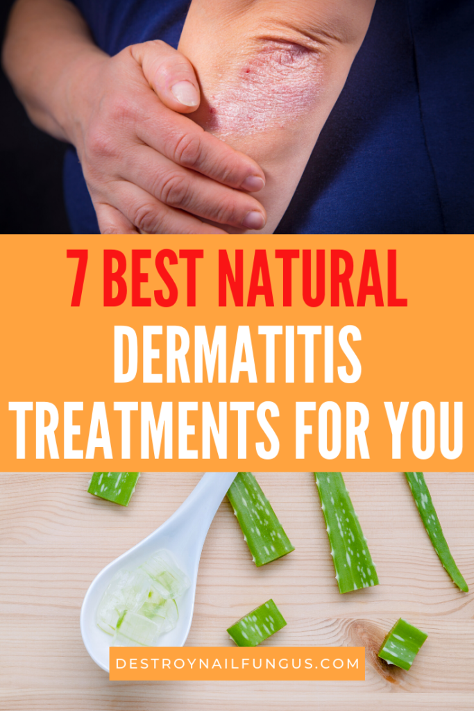 best cheap atopic dermatitis itch relief medication us
