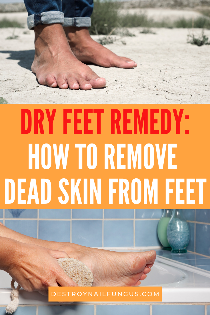 best way to scrub dead skin off feet